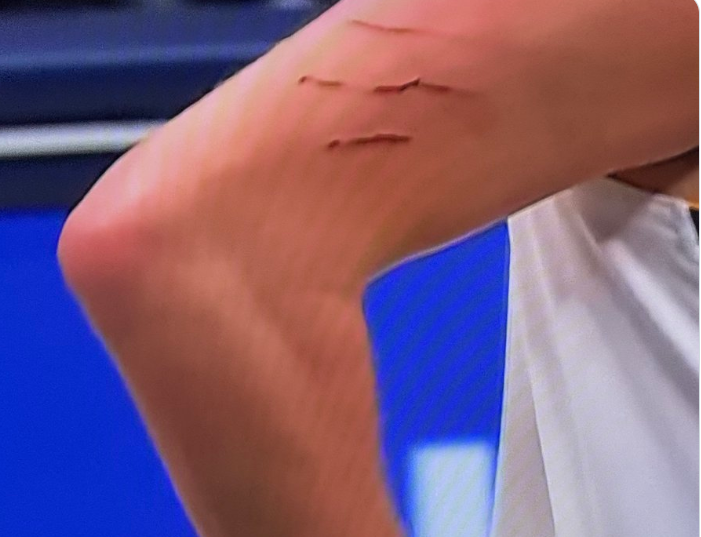 „Ве молиме, исечете ги ноктите за доброто на Никола Јокиќ“